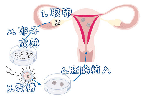 人工高龄供卵代怀微信群
